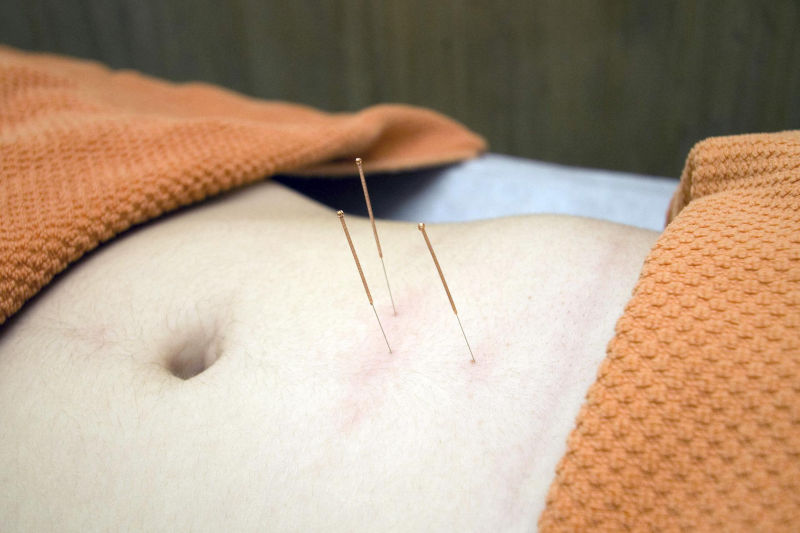 Acupuncture San Luis Obispo